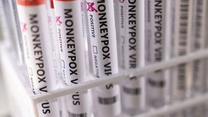 Belgium Buat Kuarantin Demam Monyet (Monkeypox) Tanda Pandemik Baru?